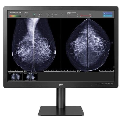 LG 31IN Medical Anti-Glare, 3H DIGNOSTIC Monitor 4200 X 2800 (3:2) Class II FDA